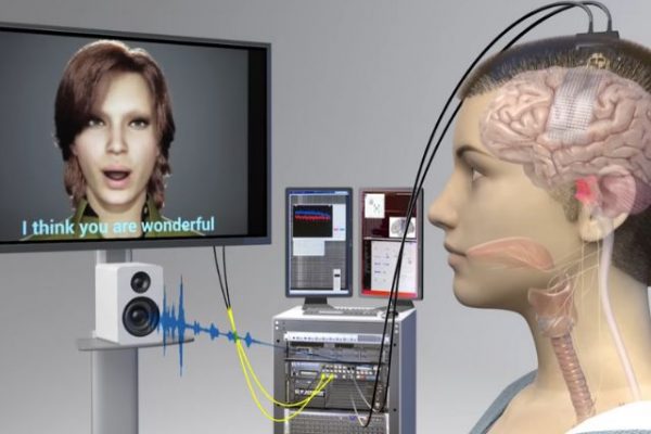 Tecnología de IA permite a paciente de derrame cerebral hablar después de 18 años