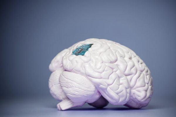 Neuralink: lo que hay detrás y el futuro de implantes cerebrales como el creado por Elon Musk