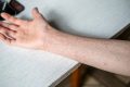 Sarampión: ¿cómo hacer frente al aumento del número de casos?