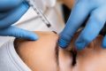 Inyecciones de bótox: ¿cuál es su composición y qué riesgos implica?
